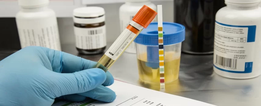 la compensacion laboral y los analisis de drogas