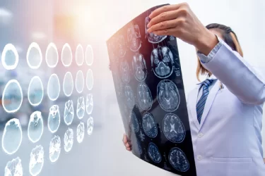 ¿Puede un abogado de lesiones cerebrales de Nueva York ayudarme a resolver mi caso?